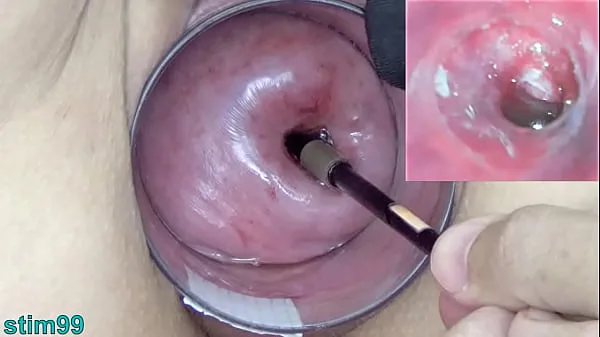 Dojrzała Milf Cervix Play z endoskopem Japońska kamera do macicy